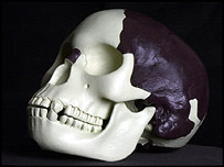 the Piltdown skull
