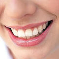 Teeth whitening 5408.jpg